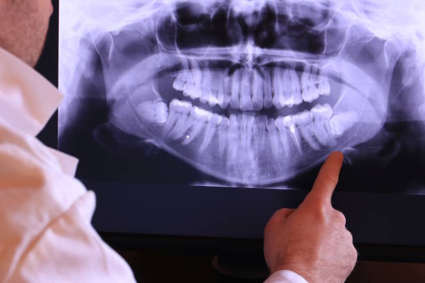 Best Emergency Dental Services for Seniors in Exeter, CA